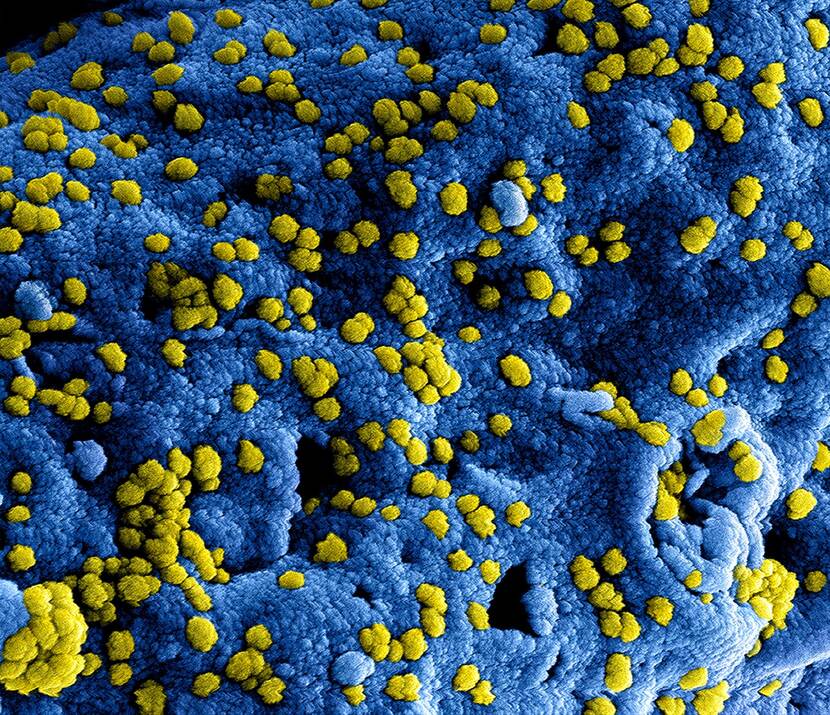 Corona virus (COVID-19)